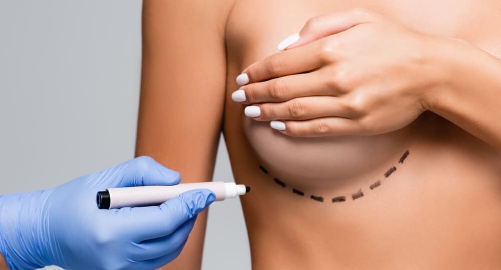 Reafirmación de senos después del embarazo: soluciones modernas y sin cicatrices